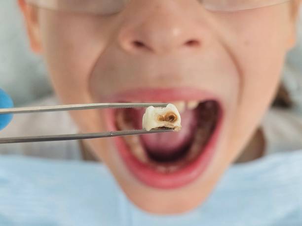 Best Emergency Cosmetic Dentistry (e.g., broken veneers) in Shallowater, TX